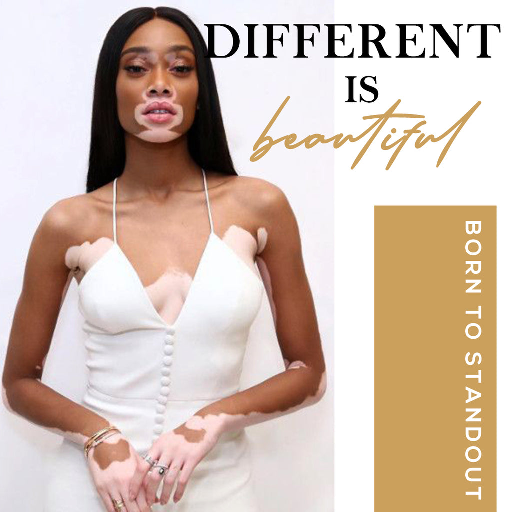 Different is Beautiful